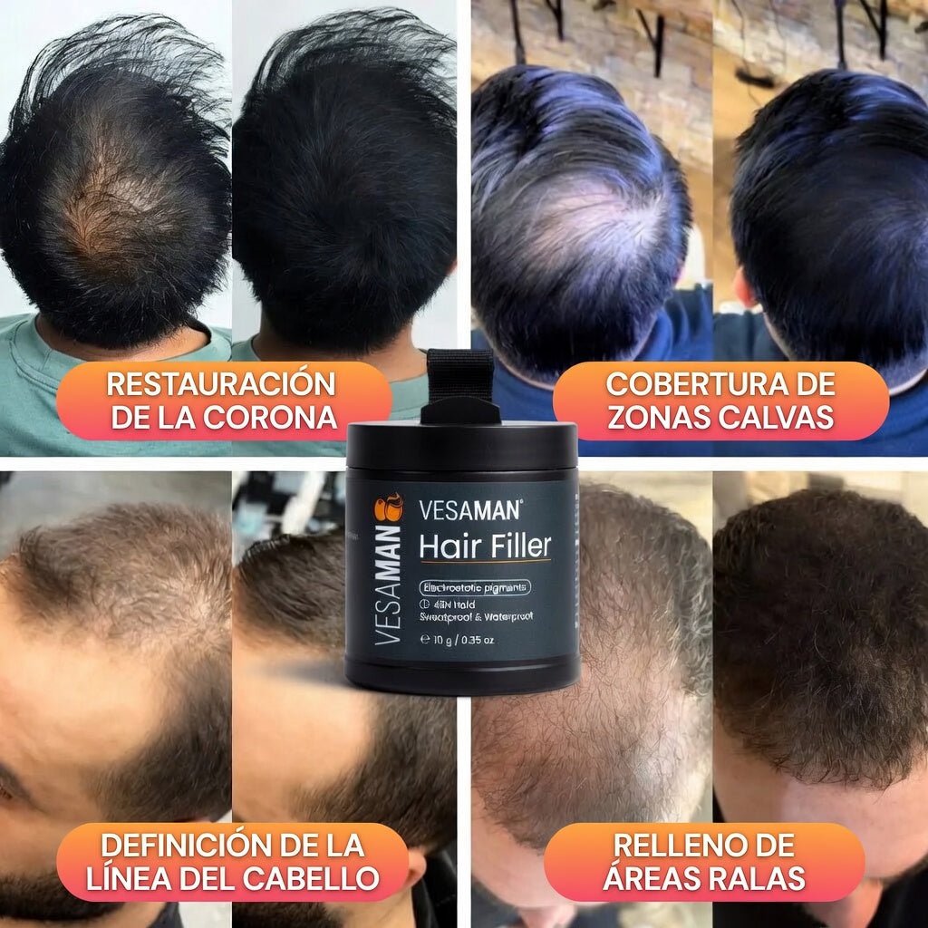 Vesaman™ Hair Filler